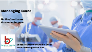 Managing Burns